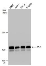STAG2 Antibody in Western Blot (WB)