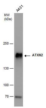 Ataxin 2 Antibody in Western Blot (WB)