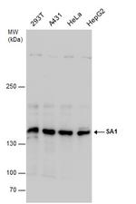 STAG1 Antibody in Western Blot (WB)