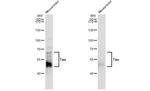 Phospho-Tau (Ser262) Antibody in Western Blot (WB)