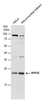 RPP25 Polyclonal Antibody
