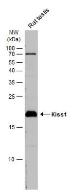 KISS1 Polyclonal Antibody