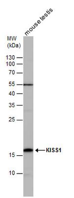 KISS1 Antibody in Western Blot (WB)