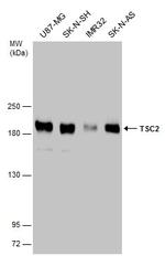 Phospho-TSC2 (Ser939) Antibody in Western Blot (WB)