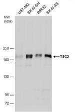 Phospho-TSC2 (Ser939) Antibody in Western Blot (WB)