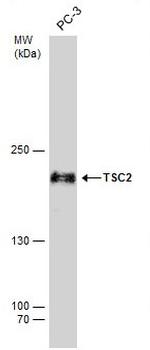 Phospho-TSC2 (Ser939) Antibody in Western Blot (WB)