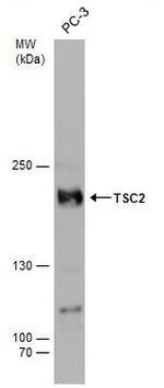 Phospho-TSC2 (Ser939) Antibody in Western Blot (WB)