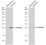 Calbindin D28K Antibody in Western Blot (WB)