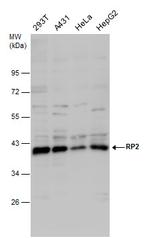 RP2 Polyclonal Antibody