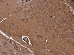 GAMT Polyclonal Antibody