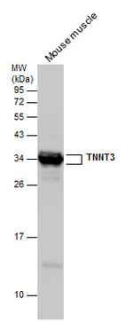 TNNT3 Polyclonal Antibody