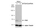 PKR Antibody in Western Blot (WB)