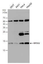 RPS12 Polyclonal Antibody