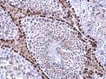WAC Antibody in Immunohistochemistry (Paraffin) (IHC (P))
