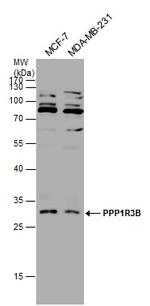 PPP1R3B Polyclonal Antibody