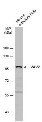 VAV2 Polyclonal Antibody