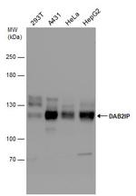 DAB2IP Polyclonal Antibody