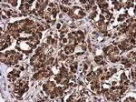 LIN28B Antibody in Immunohistochemistry (Paraffin) (IHC (P))