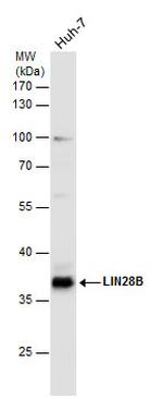 LIN28B Antibody in Western Blot (WB)