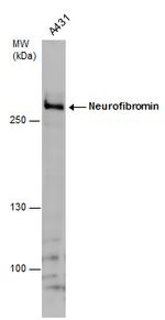 NF1 Polyclonal Antibody