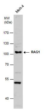 RAG1 Polyclonal Antibody