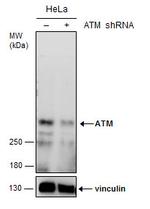 ATM Antibody in Western Blot (WB)