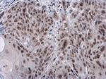 Phospho-RAD17 (Ser656) Antibody in Immunohistochemistry (Paraffin) (IHC (P))