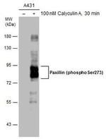Phospho-Paxillin (Ser273) Polyclonal Antibody