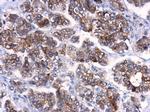 ATG10 Polyclonal Antibody