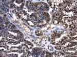 Cystatin C Polyclonal Antibody