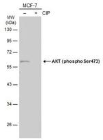 Phospho-AKT1 (Ser473) Antibody in Western Blot (WB)