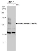 Phospho-ULK1 (Ser758) Antibody in Western Blot (WB)