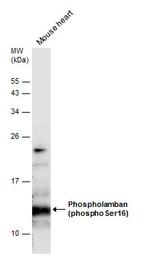 Phospho-Phospholamban (Ser16) Polyclonal Antibody