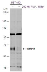 MMP14 Polyclonal Antibody