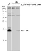 LC3A Polyclonal Antibody