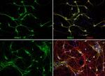MAP2 Antibody in Immunocytochemistry (ICC/IF)