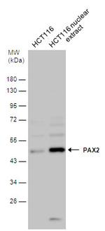 Phospho-PAX2 (Ser393) Polyclonal Antibody