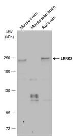 LRRK2 Antibody in Western Blot (WB)