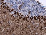 IP3 Receptor 1 Antibody in Immunohistochemistry (Paraffin) (IHC (P))