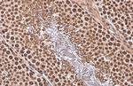 TBP Antibody in Immunohistochemistry (Paraffin) (IHC (P))