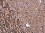 NEFM Polyclonal Antibody