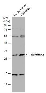 Ephrin A2 Polyclonal Antibody