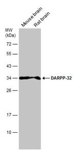 DARPP-32 Antibody in Western Blot (WB)
