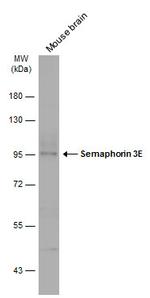 SEMA3E Antibody in Western Blot (WB)