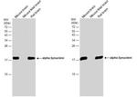 alpha Synuclein Antibody in Western Blot (WB)