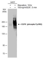 Phospho-EGFR (Tyr992) Antibody in Western Blot (WB)