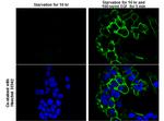 Phospho-EGFR (Tyr1173) Antibody in Immunocytochemistry (ICC/IF)