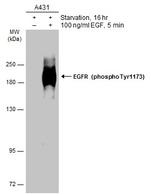 Phospho-EGFR (Tyr1173) Antibody in Western Blot (WB)
