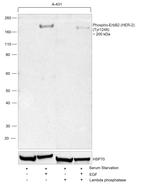 Phospho-ErbB2 (HER-2) (Tyr1248) Antibody