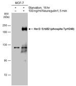 Phospho-ErbB2 (HER-2) (Tyr1248) Antibody in Western Blot (WB)